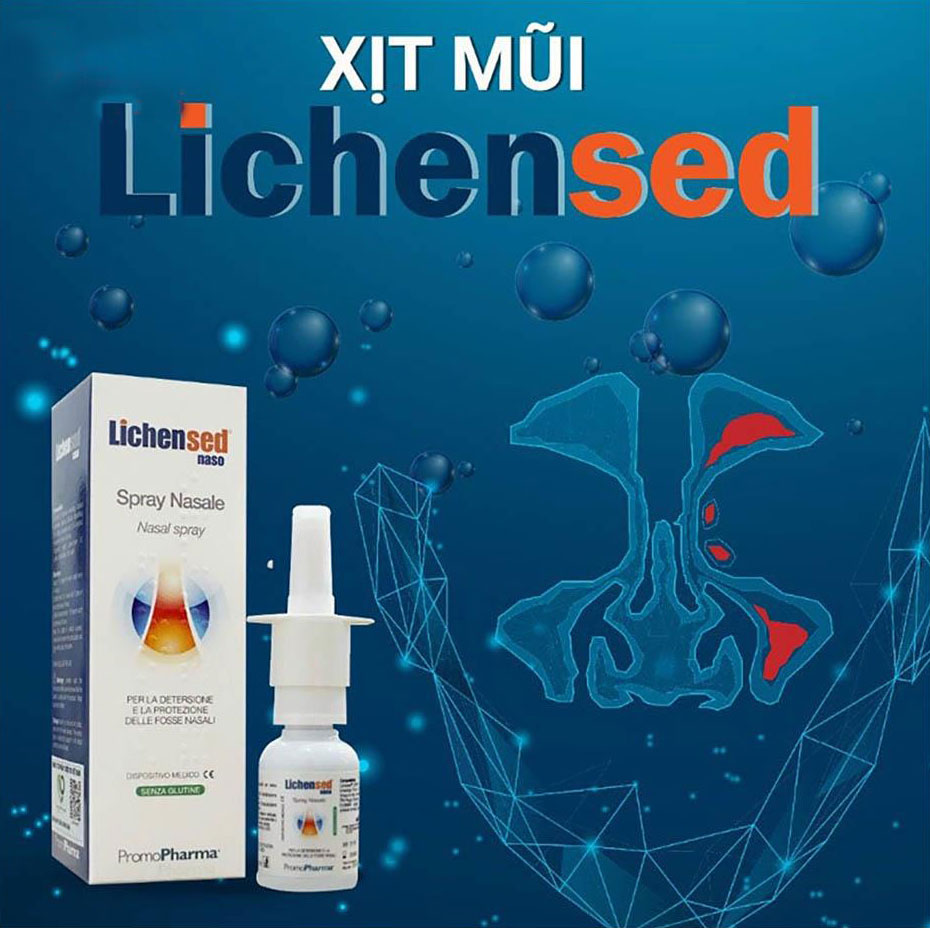 Xịt mũi Lichensed Spray Nasale