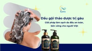 Dầu gội thảo dược trị gàu